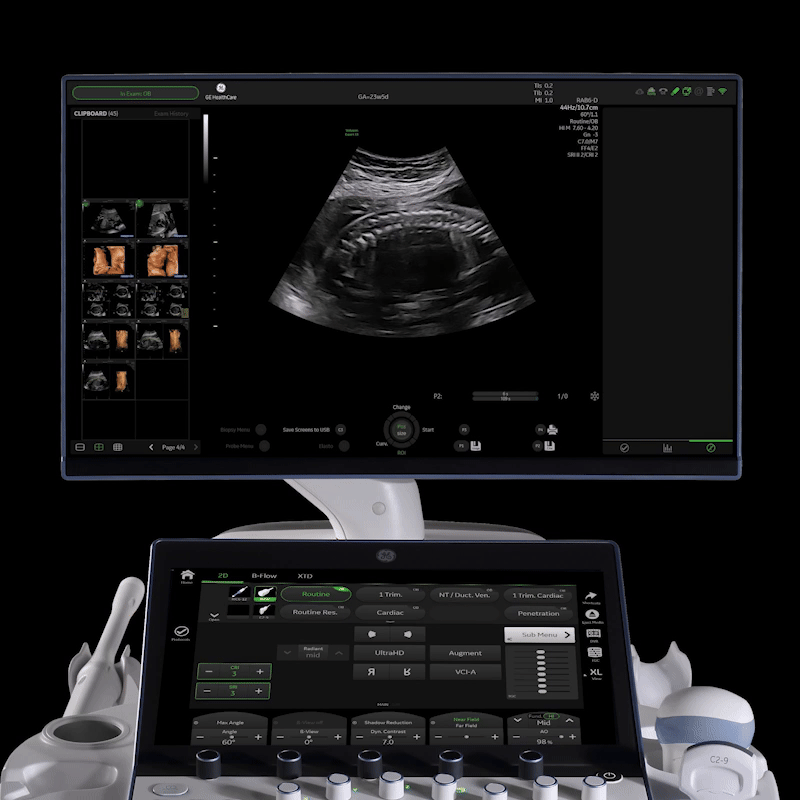 Spine Trace